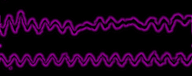 Effects of 6-10 Hz ELF on Brain Waves